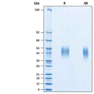 2 μg/lane of Recombinant Cynomolgus Monkey/Rhesus Macaque IL-21R His-tag (Catalog # 10837-R2) was resolved with SDS-PAGE under reducing (R) and non-reducing (NR) conditions and visualized by Coomassie® Blue staining, showing bands at 40-55 kDa.