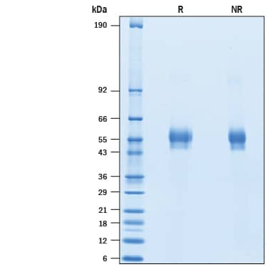 2 μg/lane of Recombinant Human Keratocan His-tag (Catalog # 10838-KE) was resolved with SDS-PAGE under reducing (R) and non-reducing (NR) conditions and visualized by Coomassie® Blue staining, showing bands at 44-62 kDa.