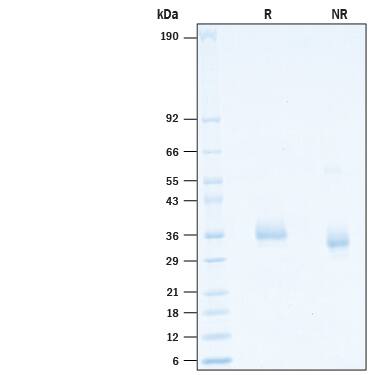2 μg/lane of Recombinant SARS-CoV-2 B.1.617.1 Spike RBD His-tag (Catalog # 10846-CV) was resolved with SDS-PAGE under reducing (R) and non-reducing (NR) conditions and visualized by Coomassie® Blue staining, showing bands at 31-38 kDa.