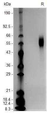 1 μg/lane of Recombinant Human GCNT2 His-tag (Catalog # 10847-GT) was resolved with SDS-PAGE under reducing (R) conditions and visualized by silver staining, showing bands at 53-63 kDa.