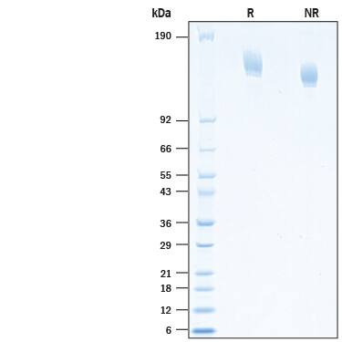 2 μg/lane of Recombinant SARS-CoV-2 +S494P B.1.1.7 Spike (GCN4-IZ) His-tag (Catalog # 10854-CV) was resolved with SDS-PAGE under reducing (R) and non-reducing (NR) conditions and visualized by Coomassie® Blue staining, showing bands at 140-170 kDa.