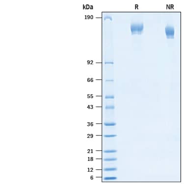 2 μg/lane of Recombinant SARS-CoV-2 P.3 Spike (GCN4-IZ) His-tag Protein (Catalog # 10855-CV) was resolved with SDS-PAGE under reducing (R) and non-reducing (NR) conditions and visualized by Coomassie® Blue staining, showing bands at 145-165 kDa.
