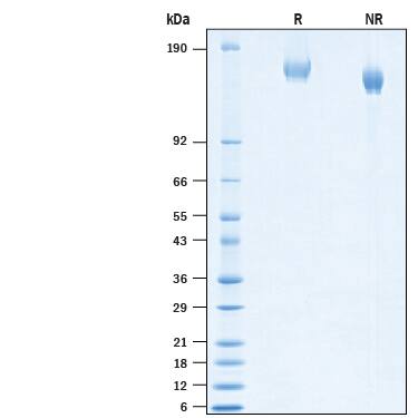2 μg/lane of Recombinant SARS-CoV-2 B.1.1.318 Spike (GCN4-IZ) His-tag Protein (Catalog # 10856-CV) was resolved with SDS-PAGE under reducing (R) and non-reducing (NR) conditions and visualized by Coomassie® Blue staining, showing bands at 145-165 kDa.