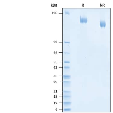 2 μg/lane of Recombinant SARS-CoV-2 A.23.1 Spike (GNC4-IZ) His-tag Protein (Catalog # 10860-CV) was resolved with SDS-PAGE under reducing (R) and non-reducing (NR) conditions and visualized by Coomassie® Blue staining, showing bands at 140-166 kDa.