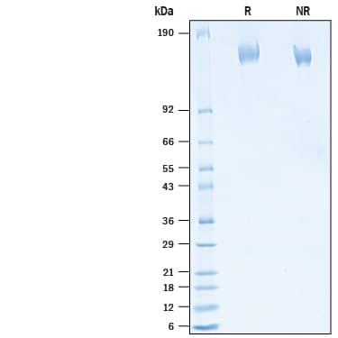2 μg/lane of Recombinant SARS-CoV-2 B.1.324.1 Spike (GCN4-IZ) His-tag Protein (Catalog # 10873-CV) was resolved with SDS-PAGE under reducing (R) and non-reducing (NR) conditions and visualized by Coomassie® Blue staining, showing bands at 140-160 kDa.