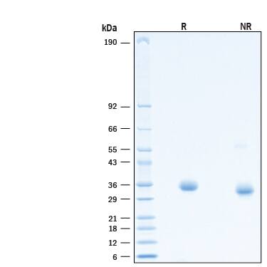 2 μg/lane of Recombinant SARS-CoV-2 T478K Spike RBD His-tag (Catalog # 10875-CV) was resolved with SDS-PAGE under reducing (R) and non-reducing (NR) conditions and visualized by Coomassie® Blue staining, showing bands at 30-38 kDa.
