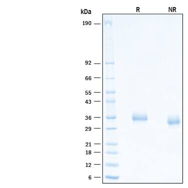 2 μg/lane of Recombinant SARS-CoV-2 C.36.3 Spike RBD His-tag Protein (Catalog # 10881-CV) was resolved with SDS-PAGE under reducing (R) and non-reducing (NR) conditions and visualized by Coomassie® Blue staining, showing bands at 32-38 kDa.