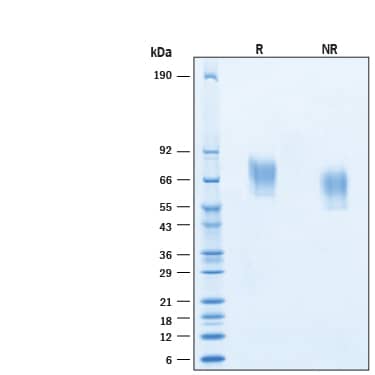 2 μg/lane of Recombinant Cynomolgus Monkey Axl His-tag Protein (Catalog # 10884-AX) was resolved with SDS-PAGE under reducing (R) and non-reducing (NR) conditions and visualized by Coomassie® Blue staining, showing bands at 57-77 kDa.