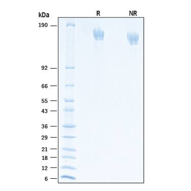 2 μg/lane of Recombinant SARS-CoV-2 C.36.3 Spike (GCN4-IZ) His Protein (Catalog # 10886-CV) was resolved with SDS-PAGE under reducing (R) and non-reducing (NR) conditions and visualized by Coomassie® Blue staining, showing bands at 142-173 kDa.