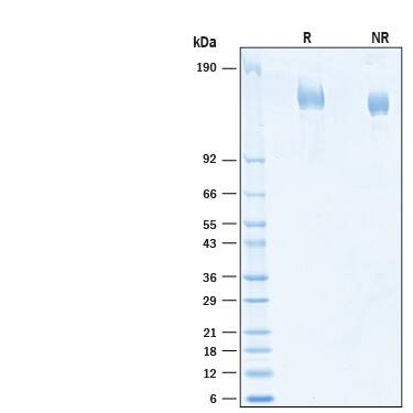 2 μg/lane of Recombinant SARS-CoV-2 C.37 Spike (GCN4-IZ) His-tag (Catalog # 10887-CV) was resolved with SDS-PAGE under reducing (R) and non-reducing (NR) conditions and visualized by Coomassie® Blue staining, showing bands at 145-170 kDa.