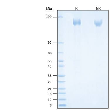 2 μg/lane of Recombinant SARS-CoV-2 Spike (GCN4-IZ) His-tag Protein (Catalog # 10895-CV) was resolved with SDS-PAGE under reducing (R) andnon-reducing (NR) conditions and visualized by Coomassie® Blue staining, showing bands at 153-172 kDa.