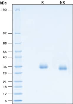 2 μg/lane of Recombinant SARS-CoV-2 B.1.621 Spike RBD His Protein (Catalog # 10897-CV) was resolved with SDS-PAGE under reducing (R) and non-reducing (NR) conditions and visualized by Coomassie® Blue staining, showing bands at 33-38 kDa.
