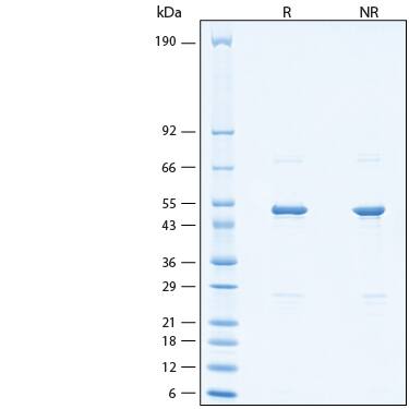 2 μg/lane of Recombinant SARS-CoV Nucleocapsid His-tag Protein (Catalog # 10898-CV) was resolved with SDS-PAGE under reducing (R) and non-reducing (NR) conditions and visualized by Coomassie® Blue staining, showing bands at 47-53 kDa.