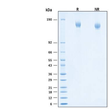 2 μg/lane of Recombinant SARS-CoV-2 AY.1/AY.2 Spike RBD His-tag Protein (Catalog # 10899-CV) was resolved with SDS-PAGE under reducing (R) and non-reducing (NR) conditions and visualized by Coomassie® Blue staining, showing bands at 142-170 kDa.