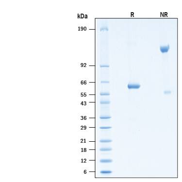 2 μg/lane of Recombinant SARS-CoV-2 B.1.617.2 Spike RBD Fc Protein (Catalog # 10901-CV) was resolved with SDS-PAGE under reducing (R) and non-reducing (NR) conditions and visualized byCoomassie® Blue staining, showing bands at 55-65 kDa and 110-130 kDa, respectively.