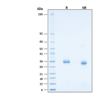 2 μg/lane of Recombinant Recombinant SARS-CoV-2 AY.1/AY.2 Spike RBD His-tag Protein (Catalog # 10905-CV) was resolved with SDS-PAGE under reducing (R) and non-reducing (NR) conditions and visualized by Coomassie® Blue staining, showing bands at 30-37 kDa.