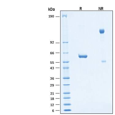 2 μg/lane of Recombinant SARS-CoV-2 B.1.617.1 Spike RBD Fc Protein (Catalog # 10906-CV) was resolved with SDS-PAGE under reducing (R) and non-reducing (NR) conditions and visualized byCoomassie® Blue staining, showing bands at 55-65 kDa and 110-130 kDa, respectively.