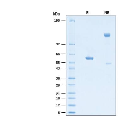 2 μg/lane of Recombinant SARS-CoV-2 P.1 Spike RBD Fc Chimera Protein (Catalog # 10914-CV) was resolved with SDS-PAGE under reducing (R) and non-reducing (NR) conditions and visualized by Coomassie® Blue staining, showing bands at 57-64 kDa and 110-130 kDa, respectively.