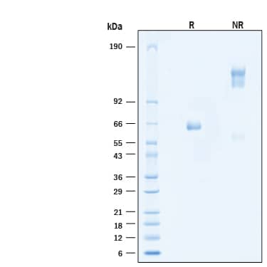 SDS-Page IL-2 R beta [Unconjugated]