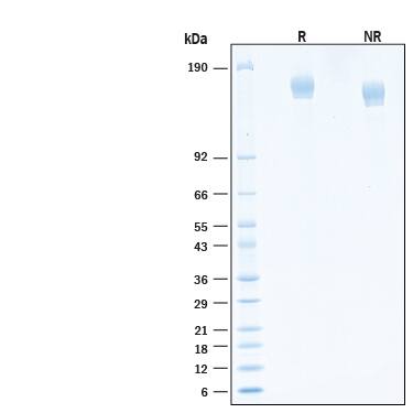 2 μg/lane of Recombinant SARS-CoV-2 AY.1 Spike (GCN4-IZ) His-tag Protein (Catalog # 10922-CV) was resolved with SDS-PAGE under reducing (R) and non-reducing (NR) conditions and visualized by Coomassie® Blue staining, showing bands at 142-170 kDa.
