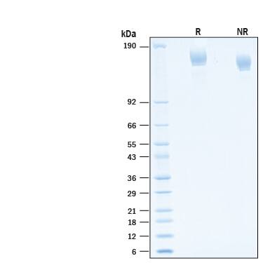2 μg/lane of Recombinant SARS-CoV-2 AY.2 Spike (GCN4-IZ) His-tag Protein (Catalog # 10923-CV) was resolved with SDS-PAGE under reducing (R) and non-reducing (NR) conditions and visualized by Coomassie® Blue staining, showing bands at 142-170 kDa.