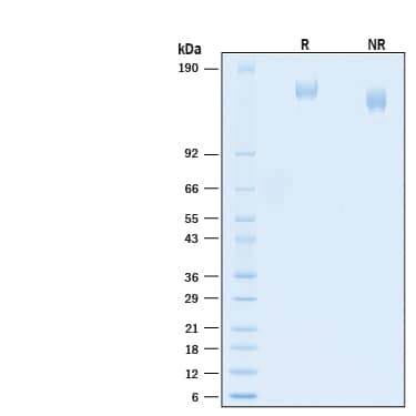 2 μg/lane of Recombinant SARS-CoV-2 B.1.617.2 Spike His-tag Protein (Catalog # 10942-CV) was resolved with SDS-PAGE under reducing (R) and non-reducing (NR) conditions and visualized byCoomassie® Blue staining, showing bands at 150-165 kDa.