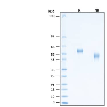 2 μg/lane of Recombinant Viral wnvNS1 His-tag Protein (Catalog # 10945-SE) was resolved with SDS-PAGE under reducing (R) and non-reducing (NR) conditions and visualized by Coomassie® Blue staining, showing bands at 52-62 kDa.
