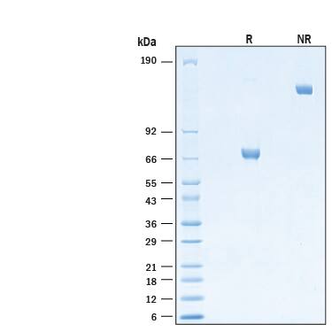 2 μg/lane of Recombinant Mouse B7‑H3 Fc Chimera Protein (Catalog # 10946-B3) was resolved with SDS-PAGE under reducing (R) and non-reducing (NR) conditions and visualized by Coomassie® Blue staining, showing bands at 65-73 kDa and 130-150 kDa, respectively.