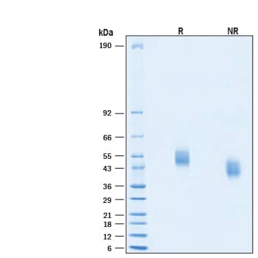 2 μg/lane of Recombinant Cynomolgus Monkey uPAR His-tag Protein (Catalog # 10949-UK) was resolved with SDS-PAGE under reducing (R) and non-reducing (NR) conditions and visualized by Coomassie® Blue staining, showing bands at 45-60 kDa.