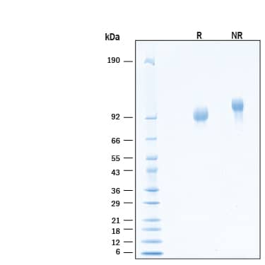 SDS-Page Serpin G1/C1 Inhibitor [Unconjugated]