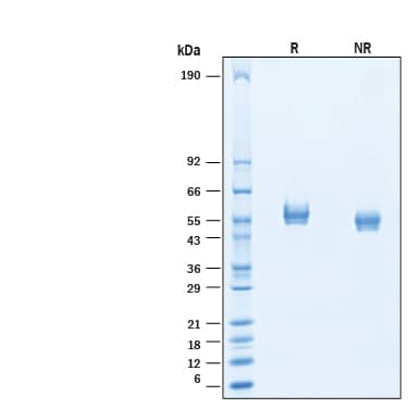 2 μg/lane of Recombinant Cynomolgus Monkey CD4 His-tag Protein (Catalog # 10952-CD) was resolved with SDS-PAGE under reducing (R) and non-reducing (NR) conditions and visualized by Coomassie® Blue staining, showing bands at 51-60 kDa.