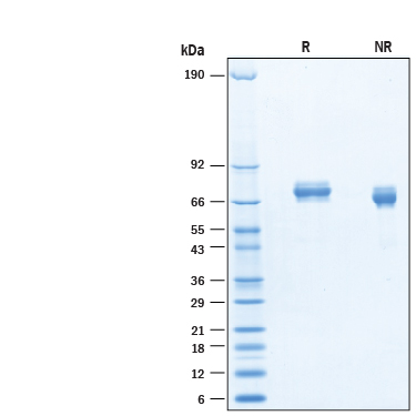 2 μg/lane of Recombinant Mouse FLRT1 His-tag Protein (Catalog # 10955-FL) was resolved with SDS-PAGE under reducing (R) and non-reducing (NR) conditions and visualized by Coomassie® Blue staining, showing bands at 65-83 kDa.