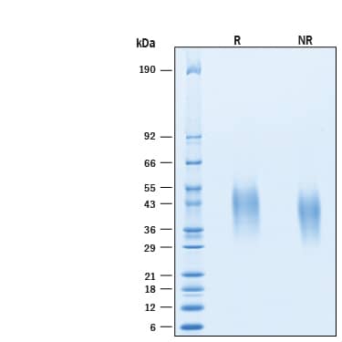 2 μg/lane of Recombinant Human GLP-1R His-tag Protein (Catalog # 10956-GL) was resolved with SDS-PAGE under reducing (R) and non-reducing (NR) conditions and visualized by Coomassie® Blue staining, showing bands at 40-50 kDa.