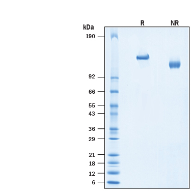 2 μg/lane of Recombinant Human Jagged 1 His-tag Protein (Catalog # 10957-JG) was resolved with SDS-PAGE under reducing (R) and non-reducing (NR) conditions and visualized by Coomassie® Blue staining, showing bands at 125-150 kDa.