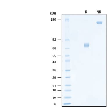 SDS-Page Mesothelin [Unconjugated]
