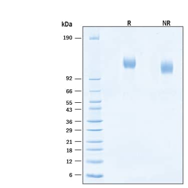 2 μg/lane of Recombinant Human VEGFR2/KDR His-tag Protein (Catalog # 10964-KD) was resolved with SDS-PAGE under reducing (R) and non-reducing (NR) conditions and visualized by Coomassie® Blue staining, showing bands at 114-126 kDa.