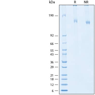 2 μg/lane of Recombinant HCoV-OC43 Spike His-tag Protein (Catalog # 10989-CV) was resolved with SDS-PAGE under reducing (R) and non-reducing (NR) conditions and visualized by Coomassie® Blue staining, showing bands at >150 kDa.