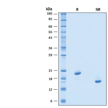 2 μg/lane of Recombinant Human IFN-alpha-4A Protein (Catalog # 10998-IF) was resolved with SDS-PAGE under reducing (R) and non-reducing (NR) conditions and visualized by Coomassie® Blue staining, showing bands at 17-23 kDa, under reducing conditions.