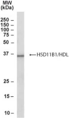 Western Blot: 11 Beta HSD1 Antibody [NB300-934] - (0.3ug/ml) staining of Human Liver lysate (35ug protein in RIPA buffer). Primary incubation was 1 hour. Detected by chemiluminescence.