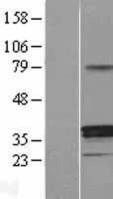 Western Blot: 11 Beta HSD1 Overexpression Lysate (Adult Normal) [NBL1-11718] Left-Empty vector transfected control cell lysate (HEK293 cell lysate); Right -Over-expression Lysate for 11 Beta HSD1.