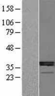 Western Blot: 11 Beta HSD1 Overexpression Lysate (Adult Normal) [NBL1-11719] Left-Empty vector transfected control cell lysate (HEK293 cell lysate); Right -Over-expression Lysate for 11 Beta HSD1.