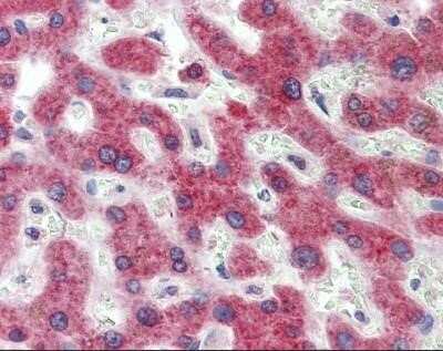 Immunohistochemistry-Paraffin: 11 beta-HSD1 Antibody [NBP1-69644] - Human liver at 5.0 ug/ml