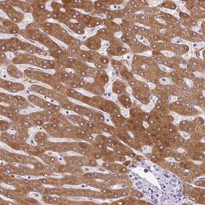 Immunohistochemistry-Paraffin: 11 beta-HSD1 Antibody [NBP2-48879] - Staining of human liver shows high expression.