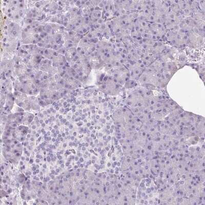 Immunohistochemistry-Paraffin: 11 beta-HSD1 Antibody [NBP2-48879] - Staining of human pancreas shows low expression as expected.