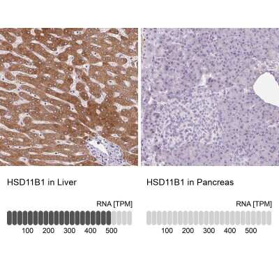 <b>Orthogonal Strategies Validation. </b>Immunohistochemistry-Paraffin: 11 beta-HSD1 Antibody [NBP2-48879] - Staining in human liver and pancreas tissues using anti-HSD11B1 antibody. Corresponding HSD11B1 RNA-seq data are presented for the same tissues.