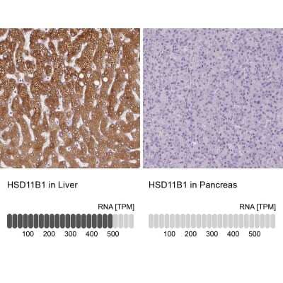 Immunohistochemistry-Paraffin: 11 beta-HSD1 Antibody [NBP2-48879] - Analysis in human liver and pancreas tissues using NBP2-48879 antibody. Corresponding HSD11B1 RNA-seq data are presented for the same tissues.