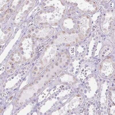 Immunohistochemistry-Paraffin: 11 beta-HSD1 Antibody [NBP2-48879] - Staining of human kidney shows weak  cytoplasmic positivity in cells in tubules.