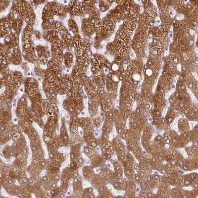 Immunohistochemistry-Paraffin: 11 beta-HSD1 Antibody [NBP2-48879] - Staining of human liver shows strong cytoplasmic positivity in hepatocytes.