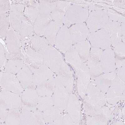 Immunohistochemistry-Paraffin: 11 beta-HSD1 Antibody [NBP2-48879] - Staining of human skeletal muscle shows negative cytoplasmic positivity in myocytes as expected.