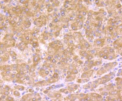 Immunohistochemistry-Paraffin: 11 beta-HSD1 Antibody (JU18-39) [NBP2-75392] - Analysis of paraffin-embedded human liver tissue using anti-HSD11B1 antibody. Counter stained with hematoxylin.